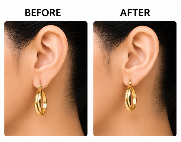 Earlobe Comfort Patches
